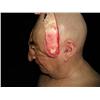Image 5 : Nip/Tuck (2003-2010) Prosthetic Head and Shoulders With Face Peeled Down