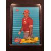 Image 1 : 1986 Fleer Pete Rose Baseball Card - Mint Condition