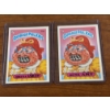 Image 1 : 1985 Garbage Pail Kids - Ghastly Ashley & Acne Amy Cards - 77A & 77B - Mint Condition