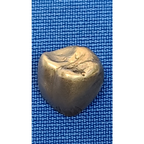 Higher Karat Gold Crown - Weight: 3.4g